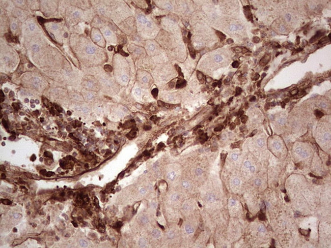 LGALS9 Antibody in Immunohistochemistry (Paraffin) (IHC (P))