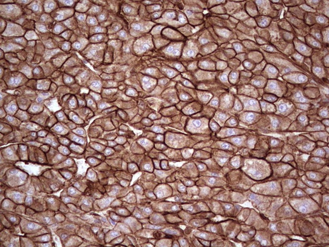 LGALS9 Antibody in Immunohistochemistry (Paraffin) (IHC (P))