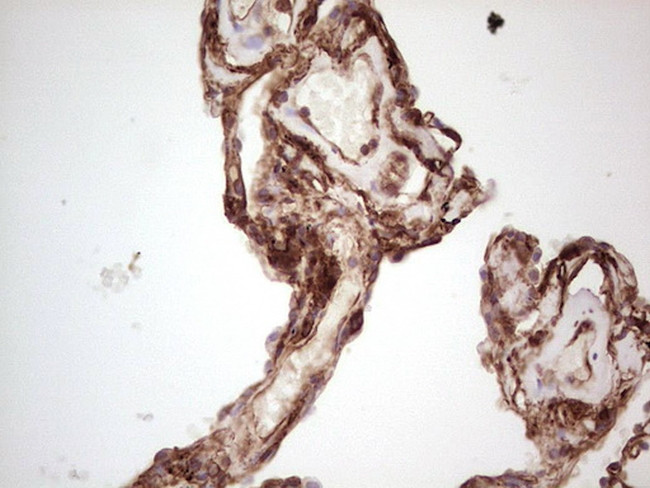 LGALS9 Antibody in Immunohistochemistry (Paraffin) (IHC (P))