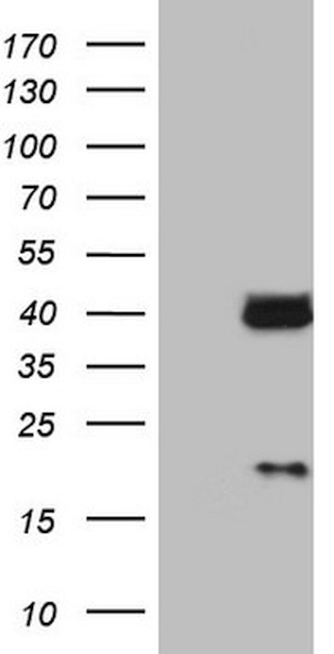 LGALS9 Antibody in Western Blot (WB)