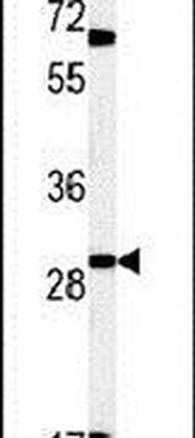 LHFPL2 Antibody in Western Blot (WB)