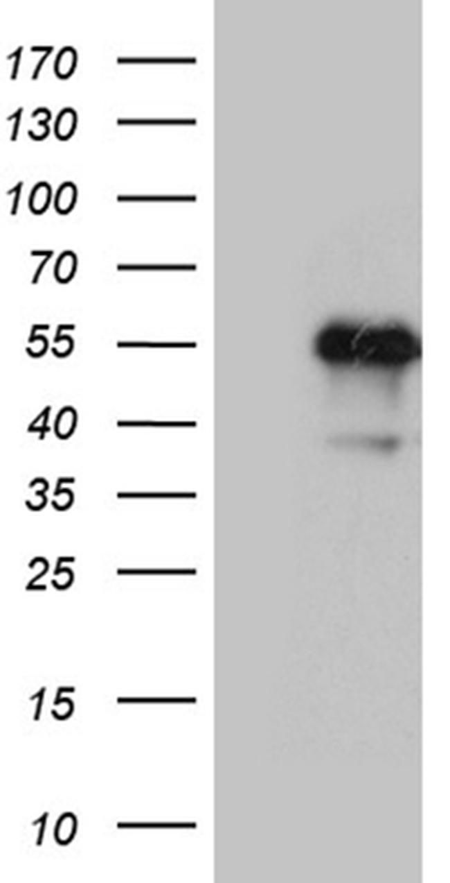 LHX2 Antibody in Western Blot (WB)