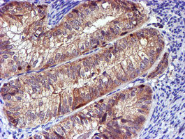 LIMK1 Antibody in Immunohistochemistry (Paraffin) (IHC (P))