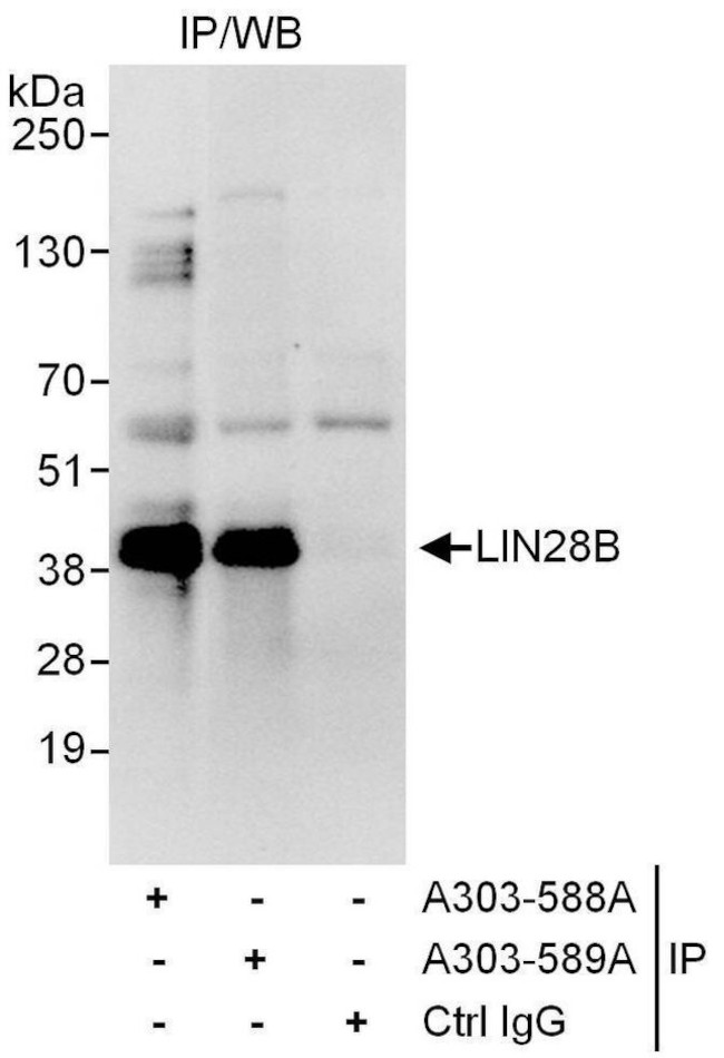 LIN28B Antibody in Immunoprecipitation (IP)