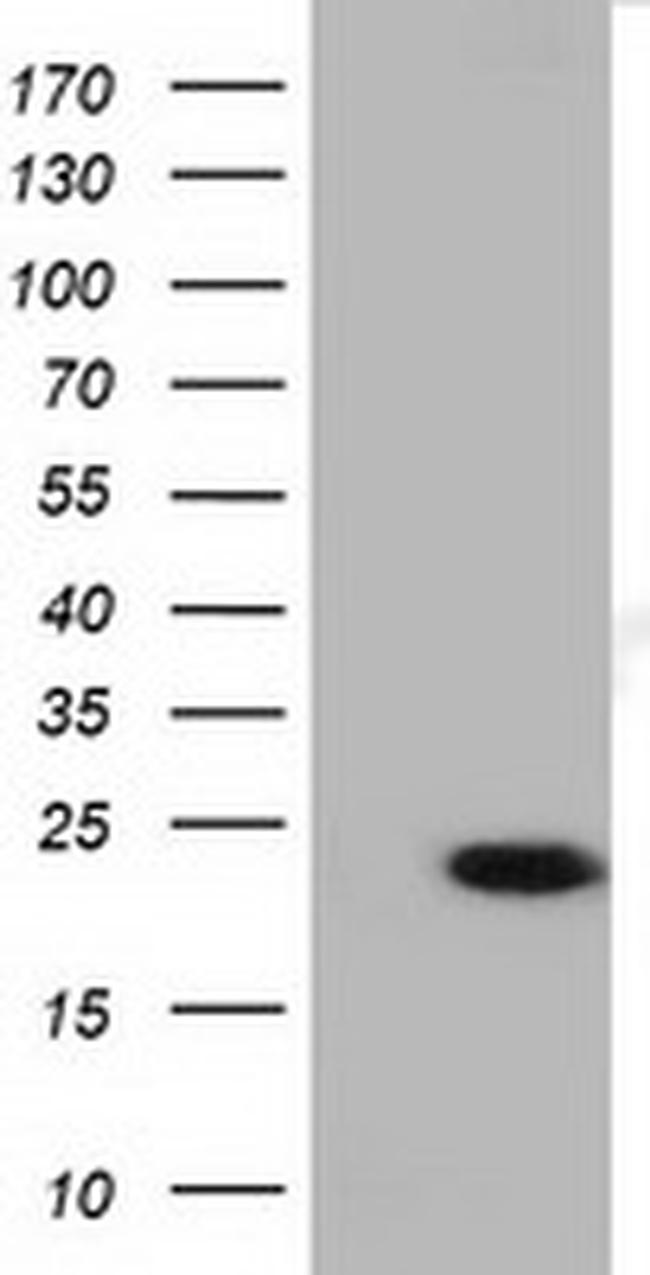 LIN7B Antibody in Western Blot (WB)