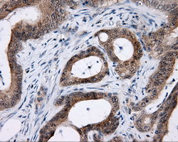 LIPG Antibody in Immunohistochemistry (Paraffin) (IHC (P))