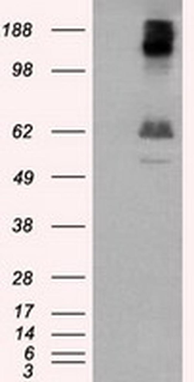 LIPG Antibody in Western Blot (WB)