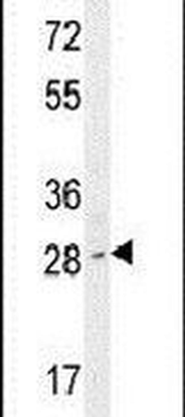 LIX1 Antibody in Western Blot (WB)