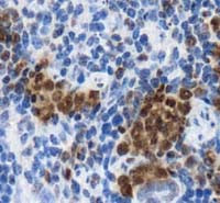 LOX Antibody in Immunohistochemistry (IHC)