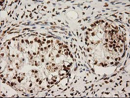 LOX Antibody in Immunohistochemistry (Paraffin) (IHC (P))