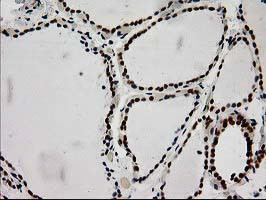 LOX Antibody in Immunohistochemistry (Paraffin) (IHC (P))