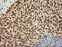 LOX Antibody in Immunohistochemistry (Paraffin) (IHC (P))