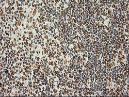 LOX Antibody in Immunohistochemistry (Paraffin) (IHC (P))