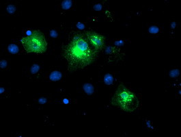 LPAR1 Antibody in Immunocytochemistry (ICC/IF)