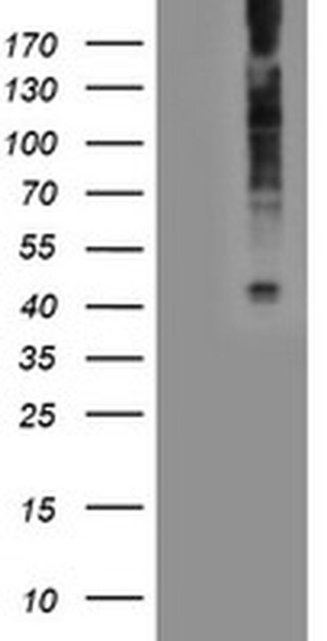 LPAR1 Antibody in Western Blot (WB)