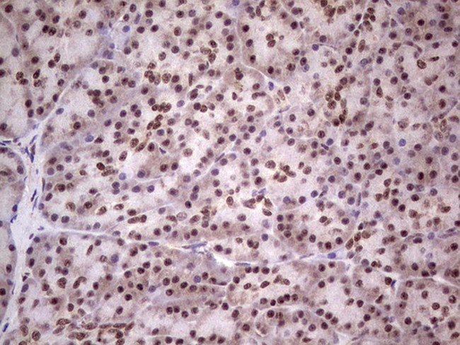 LPIN1 Antibody in Immunohistochemistry (Paraffin) (IHC (P))