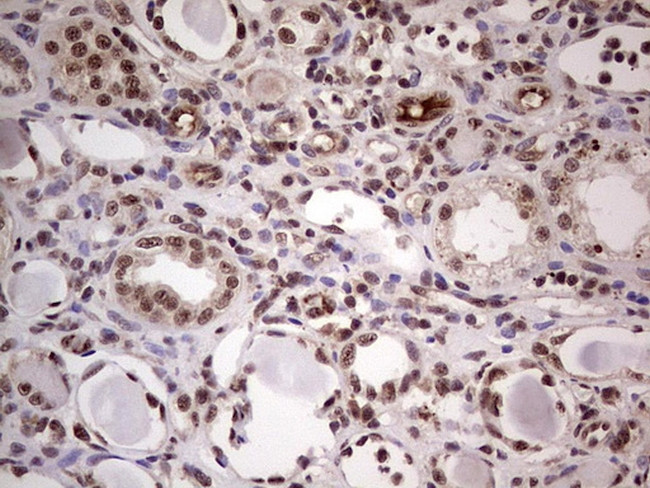 LPIN1 Antibody in Immunohistochemistry (Paraffin) (IHC (P))