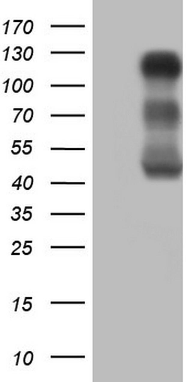 LPIN1 Antibody in Western Blot (WB)