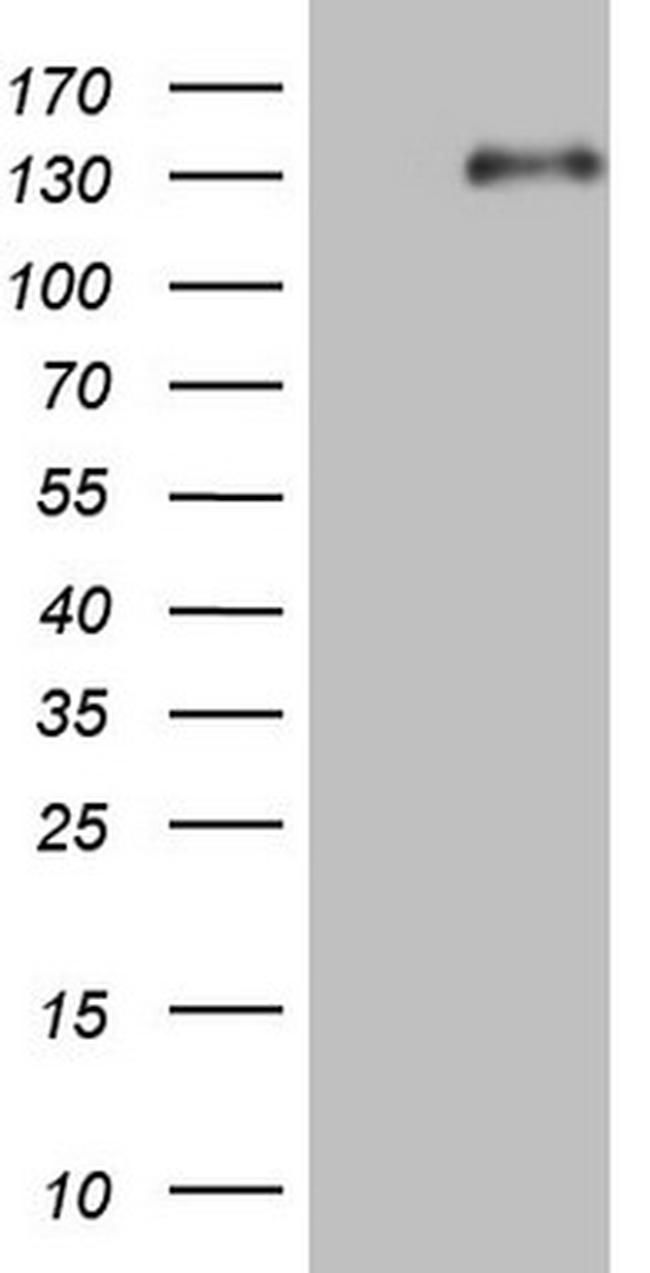 LPIN1 Antibody in Western Blot (WB)