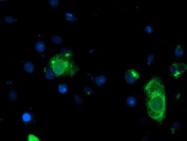 LPL Antibody in Immunocytochemistry (ICC/IF)