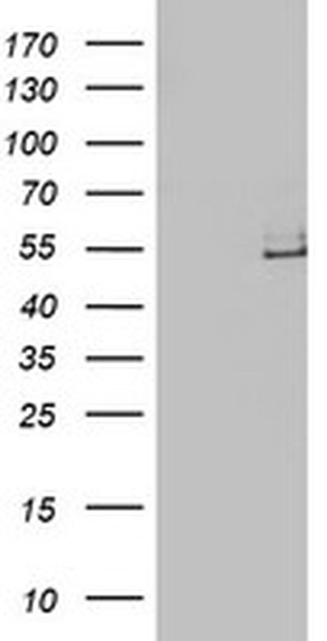 LPL Antibody in Western Blot (WB)