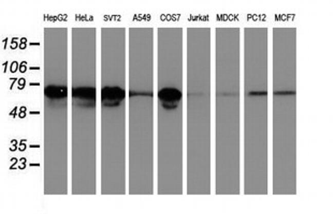 LRRC50 Antibody in Western Blot (WB)