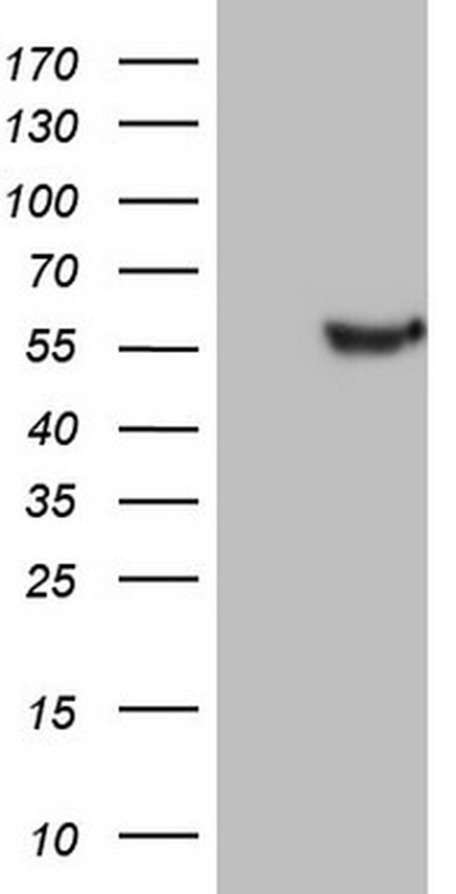 LRRC6 Antibody in Western Blot (WB)