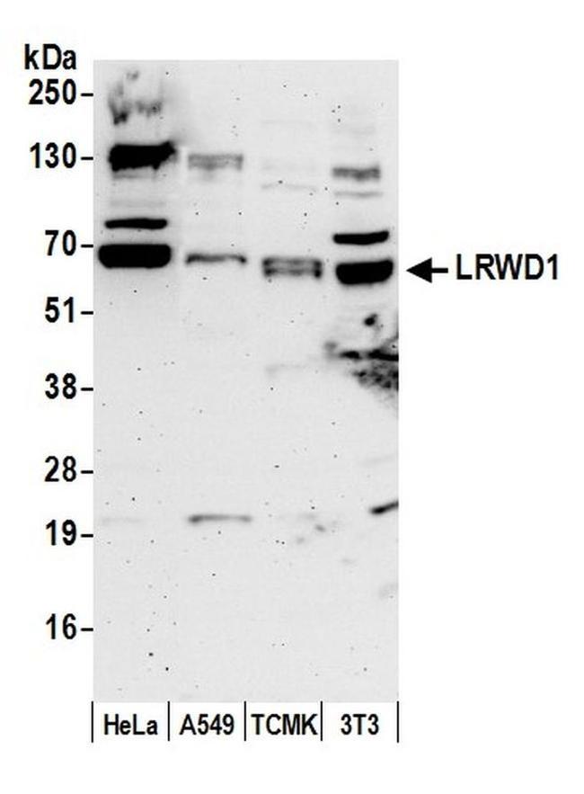 LRWD1 Antibody in Western Blot (WB)