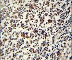 LSP1 Antibody in Immunohistochemistry (IHC)