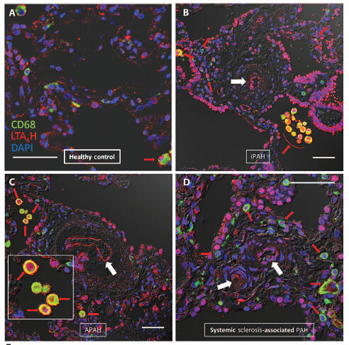 LTA4H Antibody in Immunohistochemistry (IHC)