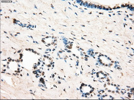 LTA4H Antibody in Immunohistochemistry (Paraffin) (IHC (P))