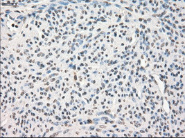 LTA4H Antibody in Immunohistochemistry (Paraffin) (IHC (P))