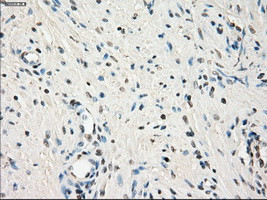 LTA4H Antibody in Immunohistochemistry (Paraffin) (IHC (P))