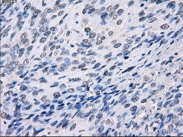 LTA4H Antibody in Immunohistochemistry (Paraffin) (IHC (P))