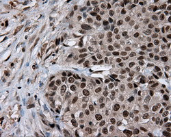 LTA4H Antibody in Immunohistochemistry (Paraffin) (IHC (P))