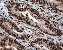 LTA4H Antibody in Immunohistochemistry (Paraffin) (IHC (P))