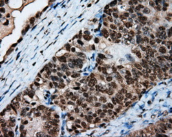 LTA4H Antibody in Immunohistochemistry (Paraffin) (IHC (P))