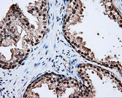 LTA4H Antibody in Immunohistochemistry (Paraffin) (IHC (P))