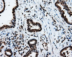 LTA4H Antibody in Immunohistochemistry (Paraffin) (IHC (P))