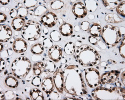 LTA4H Antibody in Immunohistochemistry (Paraffin) (IHC (P))