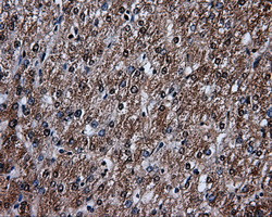 LTA4H Antibody in Immunohistochemistry (Paraffin) (IHC (P))