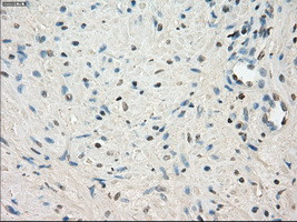 LTA4H Antibody in Immunohistochemistry (Paraffin) (IHC (P))