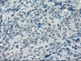 LTA4H Antibody in Immunohistochemistry (Paraffin) (IHC (P))