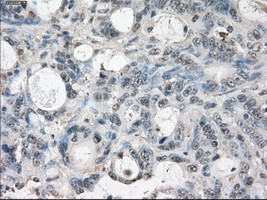 LTA4H Antibody in Immunohistochemistry (Paraffin) (IHC (P))