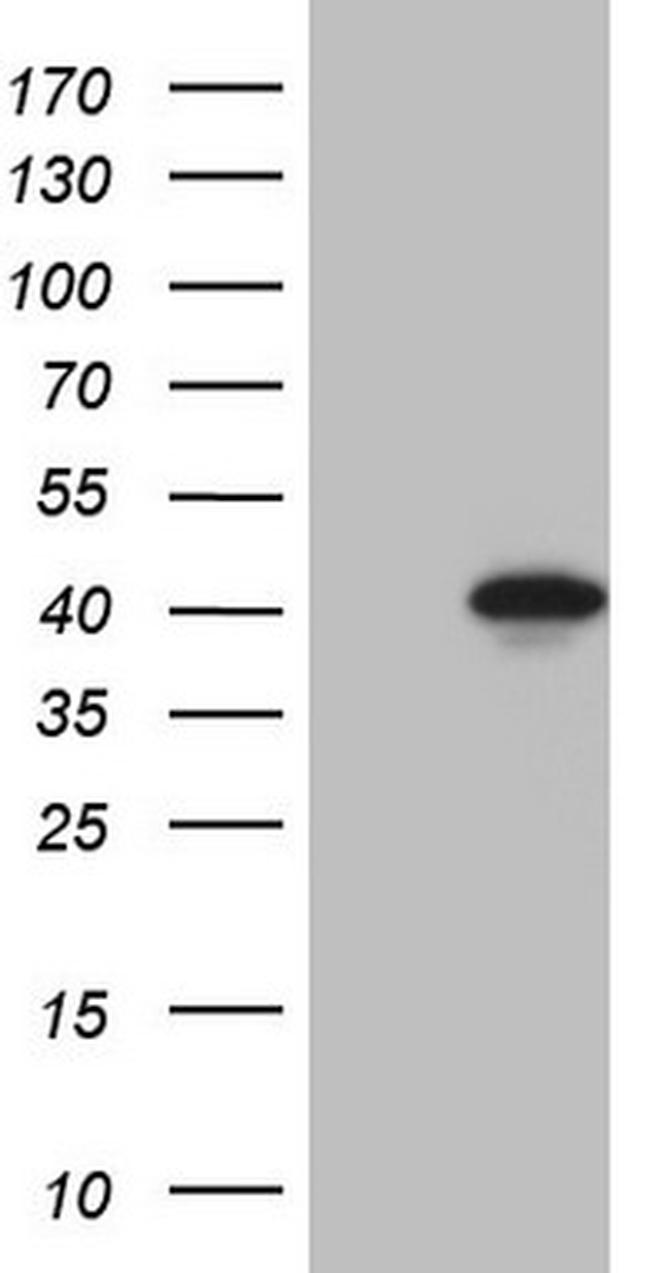 LUZP4 Antibody in Western Blot (WB)