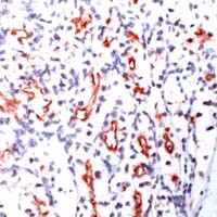 CD205 Antibody in Immunohistochemistry (IHC)