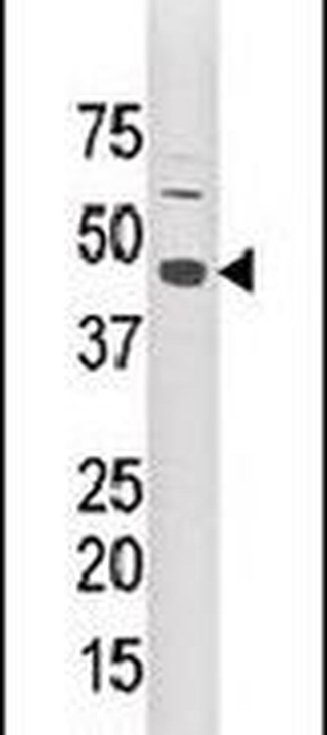 LYK5 Antibody in Western Blot (WB)