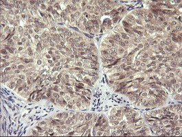 LZIC Antibody in Immunohistochemistry (Paraffin) (IHC (P))