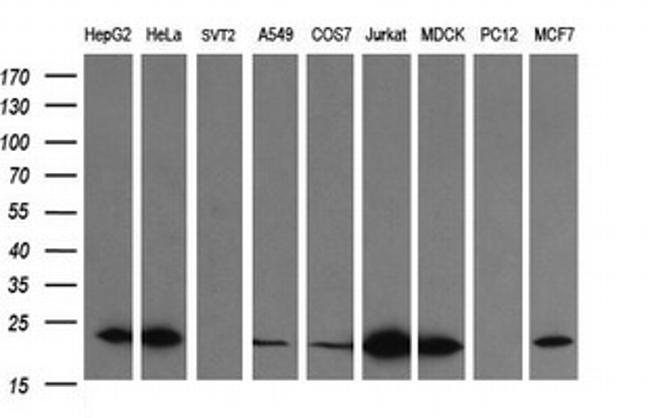 LZIC Antibody in Western Blot (WB)