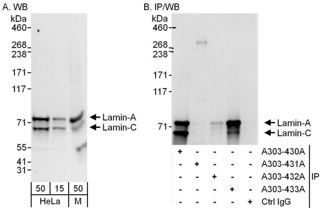 Lamin-A/C Polyclonal Antibody (A303-431A)